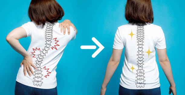 Scoliosis Treatment without Surgery – 4 Options That Really Work