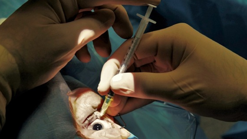 Cornea Transplant Surgery- Procedure, Cost and Recovery