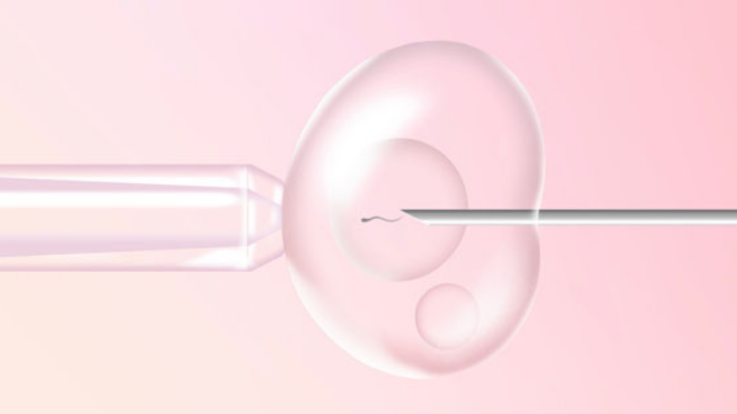 Understanding the IVF Treatment Journey