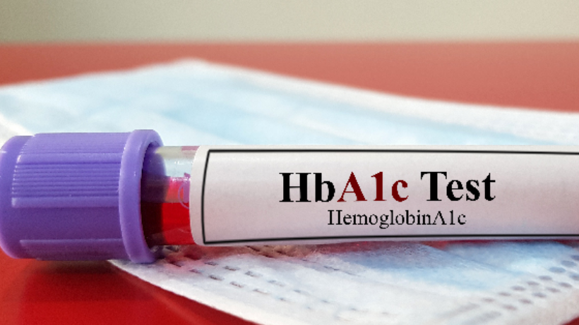 HbA1C Test: Procedure, Cost, Management All You Need To Know