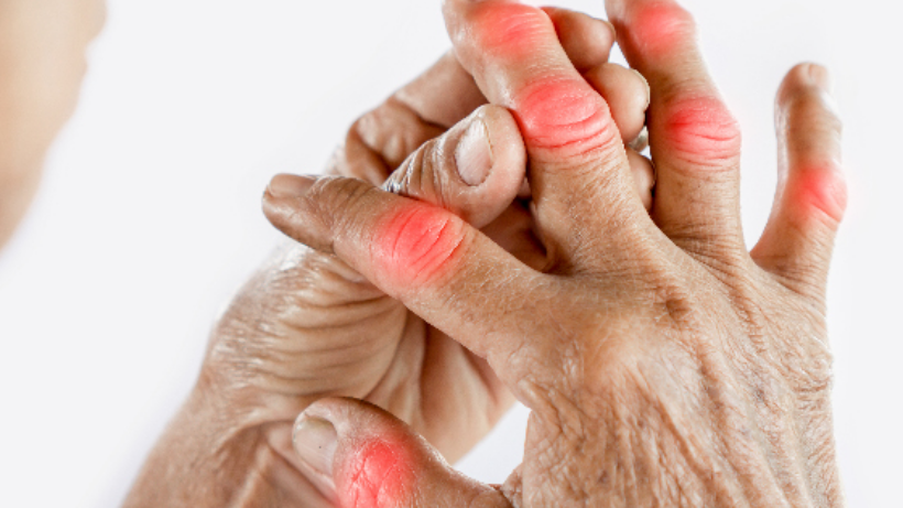 Suffering From Arthritis? Know All Your Treatment Options