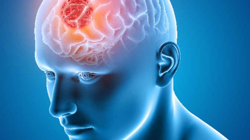 7 warning signs of a brain tumour one must know