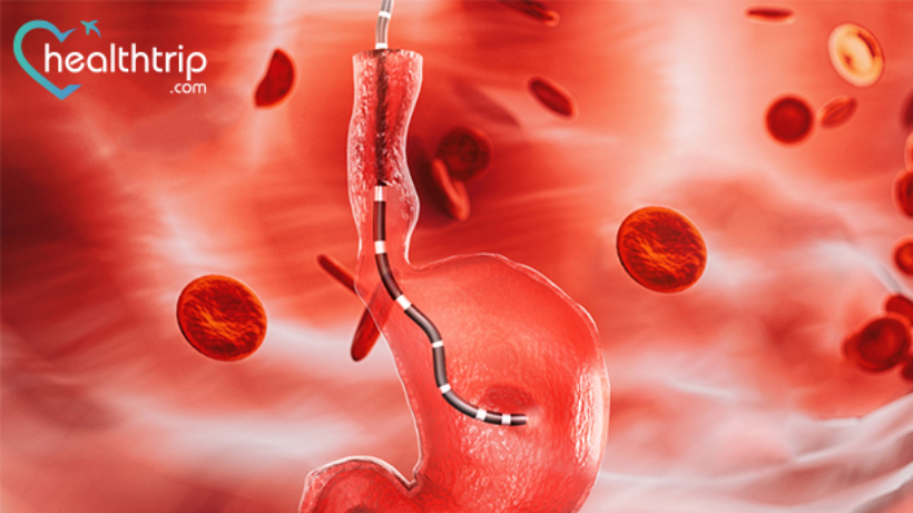 Sigmoidoscopy: Prosedur, Kos, Semua yang Anda Perlu Tahu