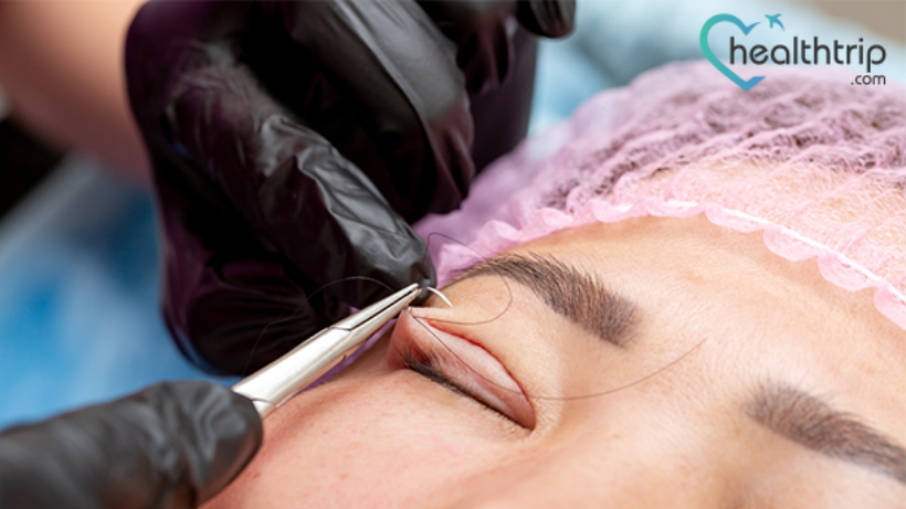 From Procedure to Cost: Here’s All You Need to Know About Ptosis Surgery