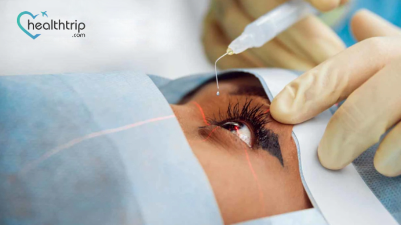 How Long Does Cataract Surgery Take in India? Procedure and Timeline