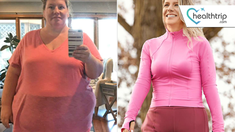 Kimberly celebrates 215-pound weight loss after gastric sleeve