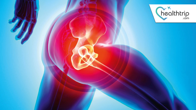 Pros and Cons of Hip Replacement Surgery in India