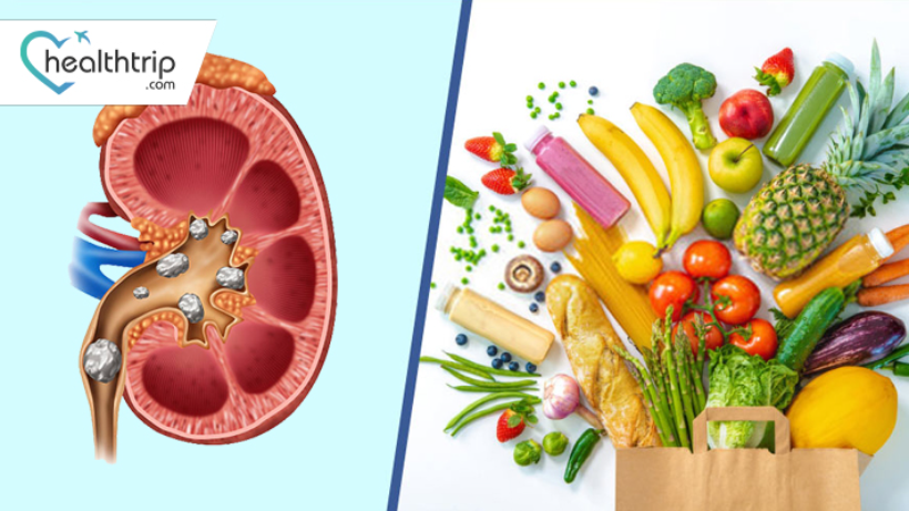 The Link Between Kidney Stones and Diet: Understanding the Role of Nutrition in Treatment