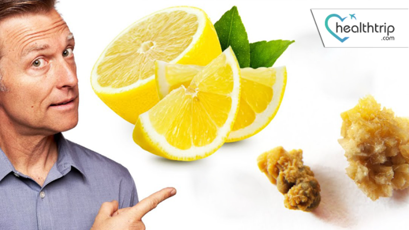 عصير الليمون علاج منزلي لتخفيف حصوات الكلى