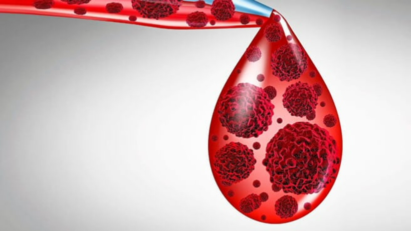 Blood cancer: Types, symptoms, causes, and treatments