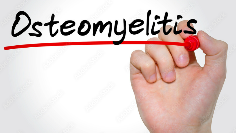 Osteomyelitis: Causes, symptoms, and treatment