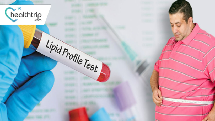  Lipid Profile Test: A Comprehensive Guide to Cholesterol and Heart Health