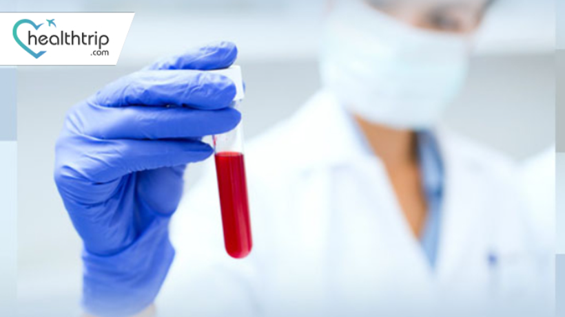  Anti-TPO Test and Thyroid Wellness