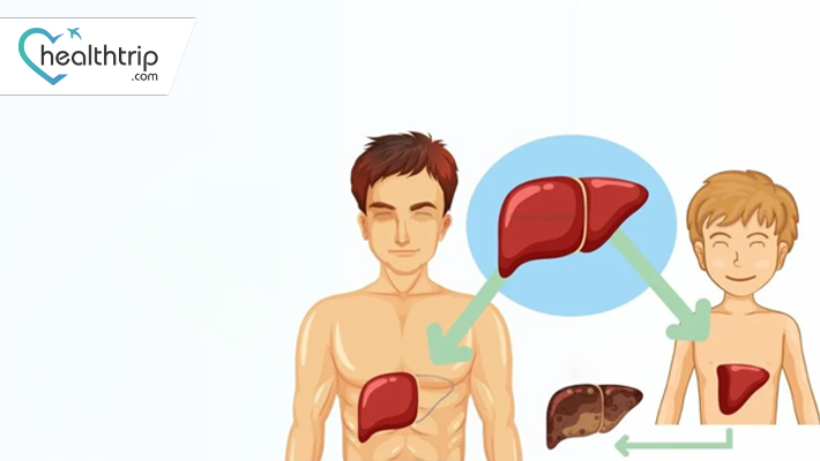 Pediatric vs. Adult Liver Transplants: Key Differences and Considerations 