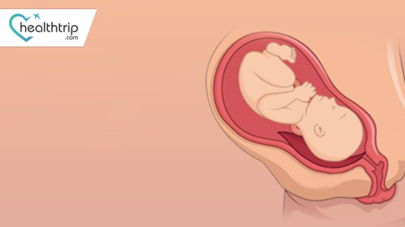 Pandangan Lebih Dekat pada Placenta Previa: Punca, Komplikasi dan Penjagaan