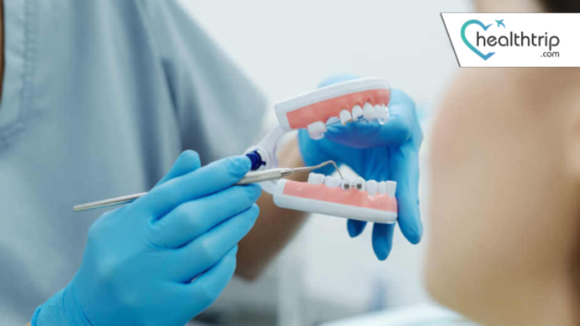 تقنيات طب الأسنان المتقدمة: تفوق تايلاند في تقديم حلول طب الأسنان المتطورة