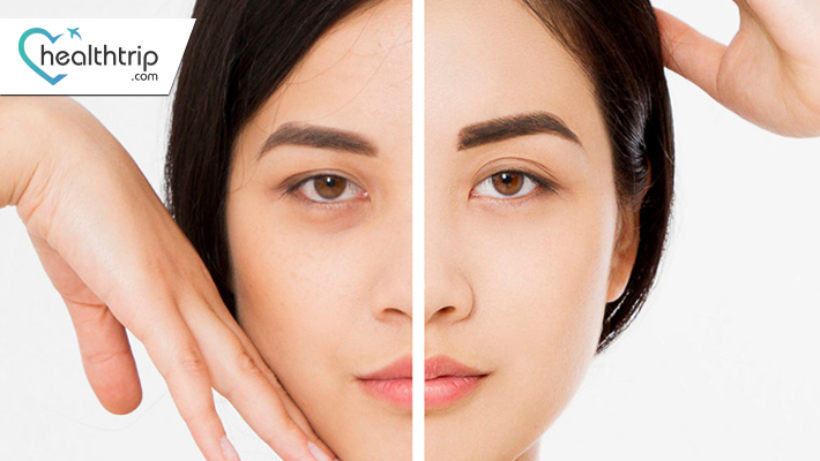 Microdermabrasion vs. Chemical Peels: Choosing the Right Package Treatment