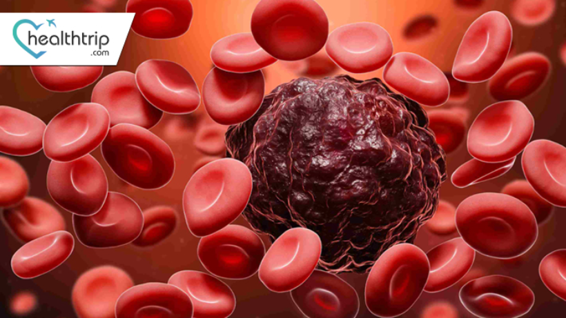 سرطان الدم: أنواعه وأعراضه وأسبابه وطرق علاجه