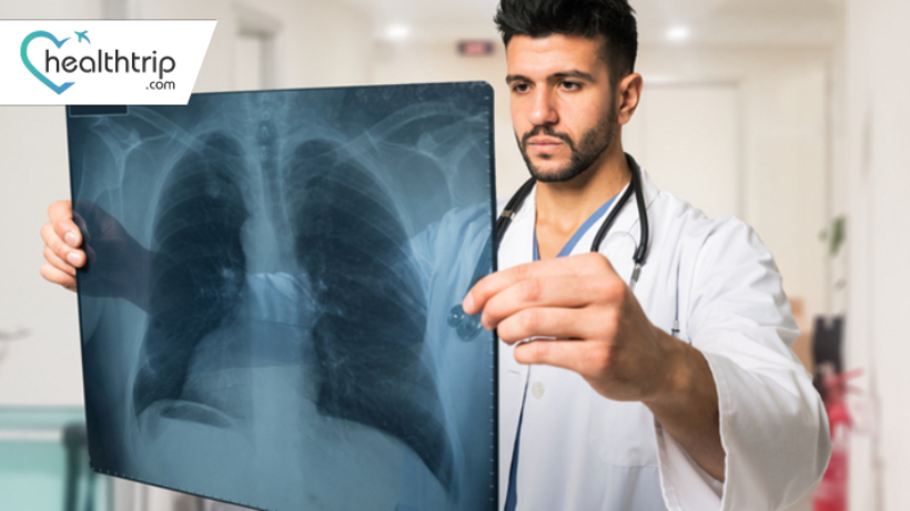 Lung Cancer Stages And Treatments In The Uae Healthtrip