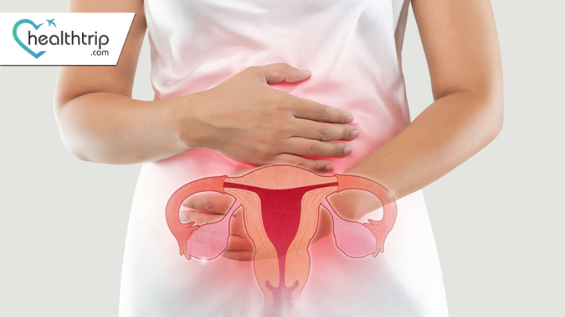 All You Need to Know about  Ovarian Cancer